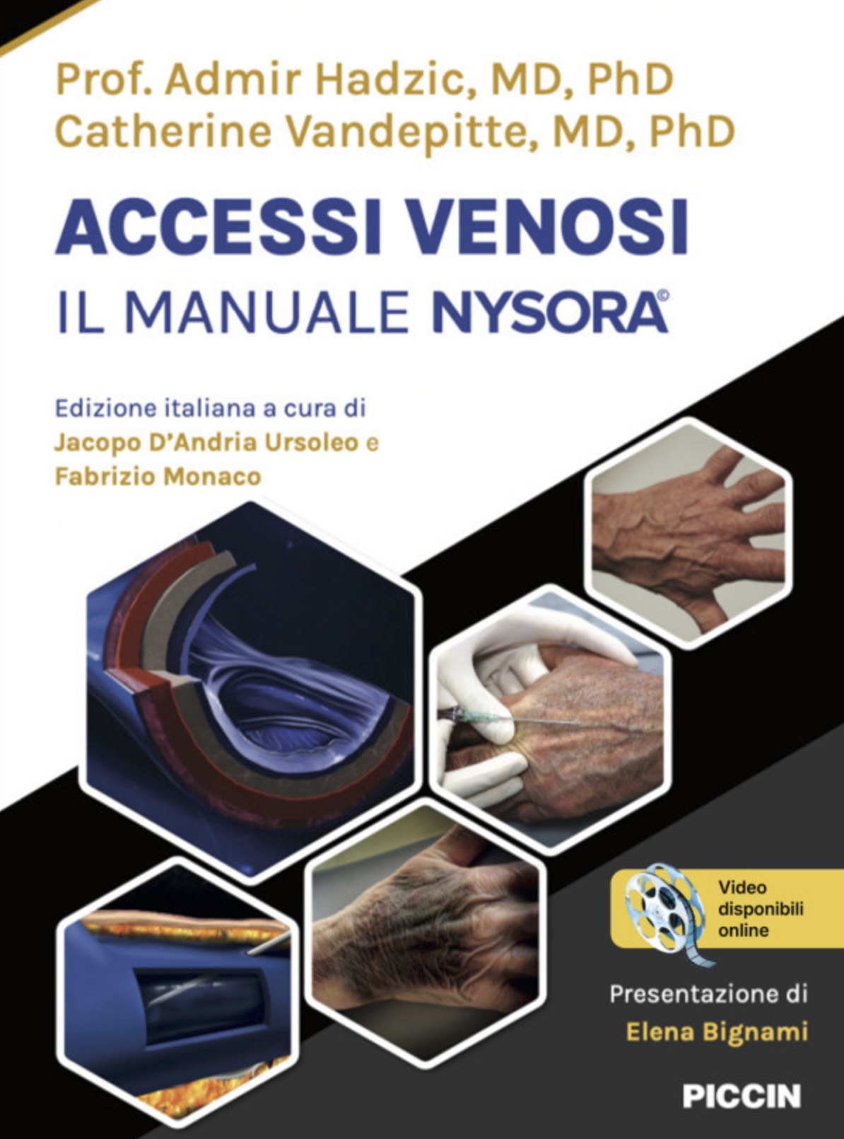 Accessi venosi. Il Manuale NYSORA©